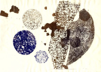 http://ottoheigold.ch/files/gimgs/th-19_14_mutation7n_v3.jpg